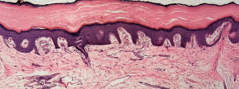 tropokolagen_endocare_centrum_leczenia_ran